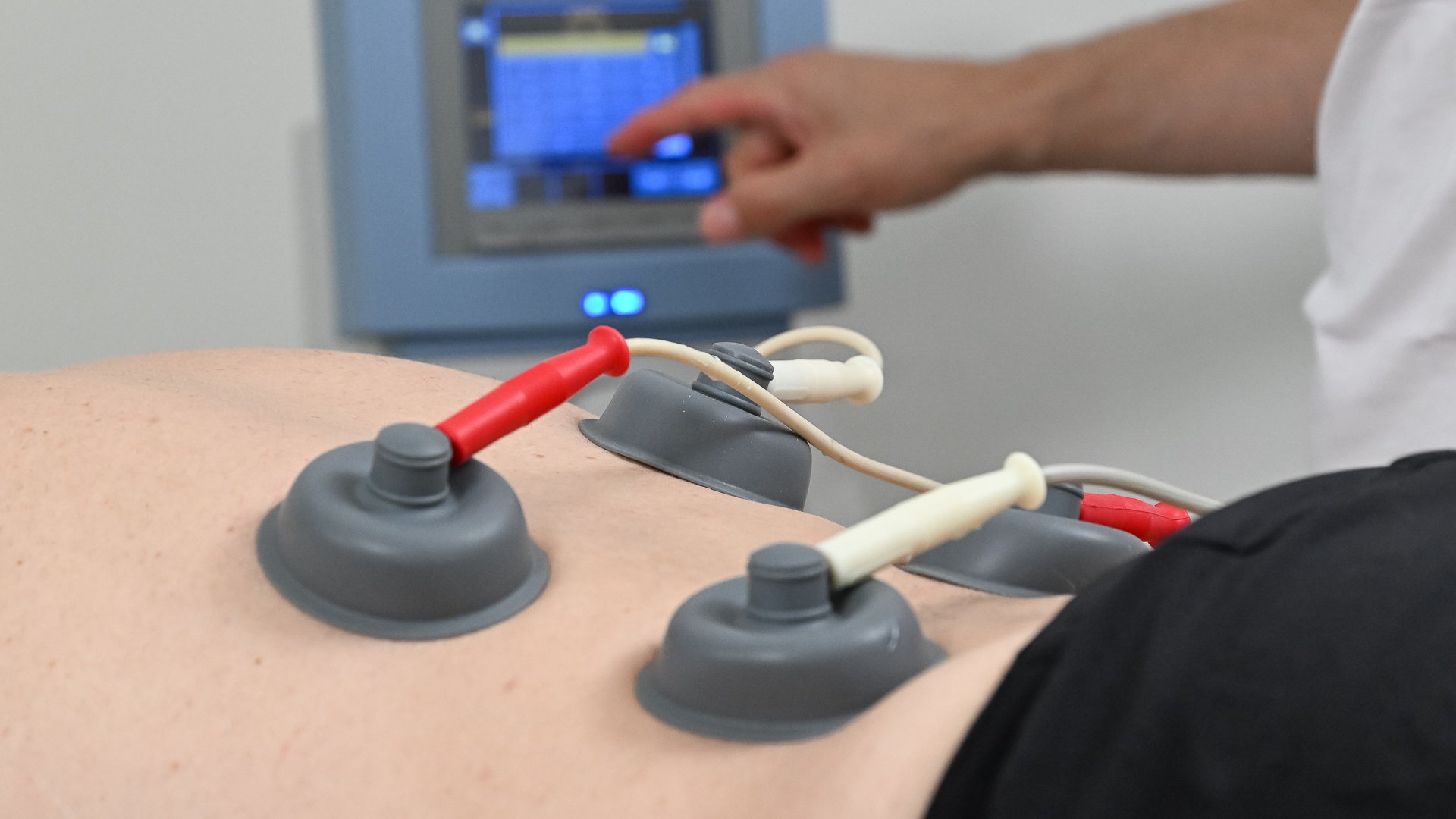 Električna stimualcija v ambulanti fizioterapija Roman Ljubljana